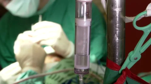 Hospital. Hands of surgeons team  performing operation. Patient during surgery.  Video stock 61069802