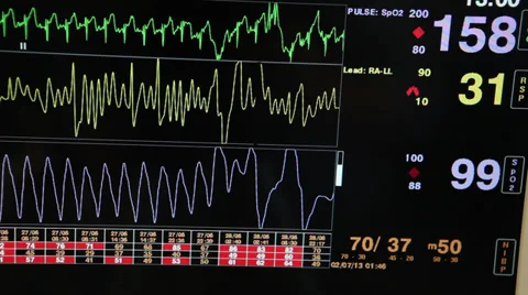 26,700+ Heart Rate Monitor Stock Videos and Royalty-Free Footage