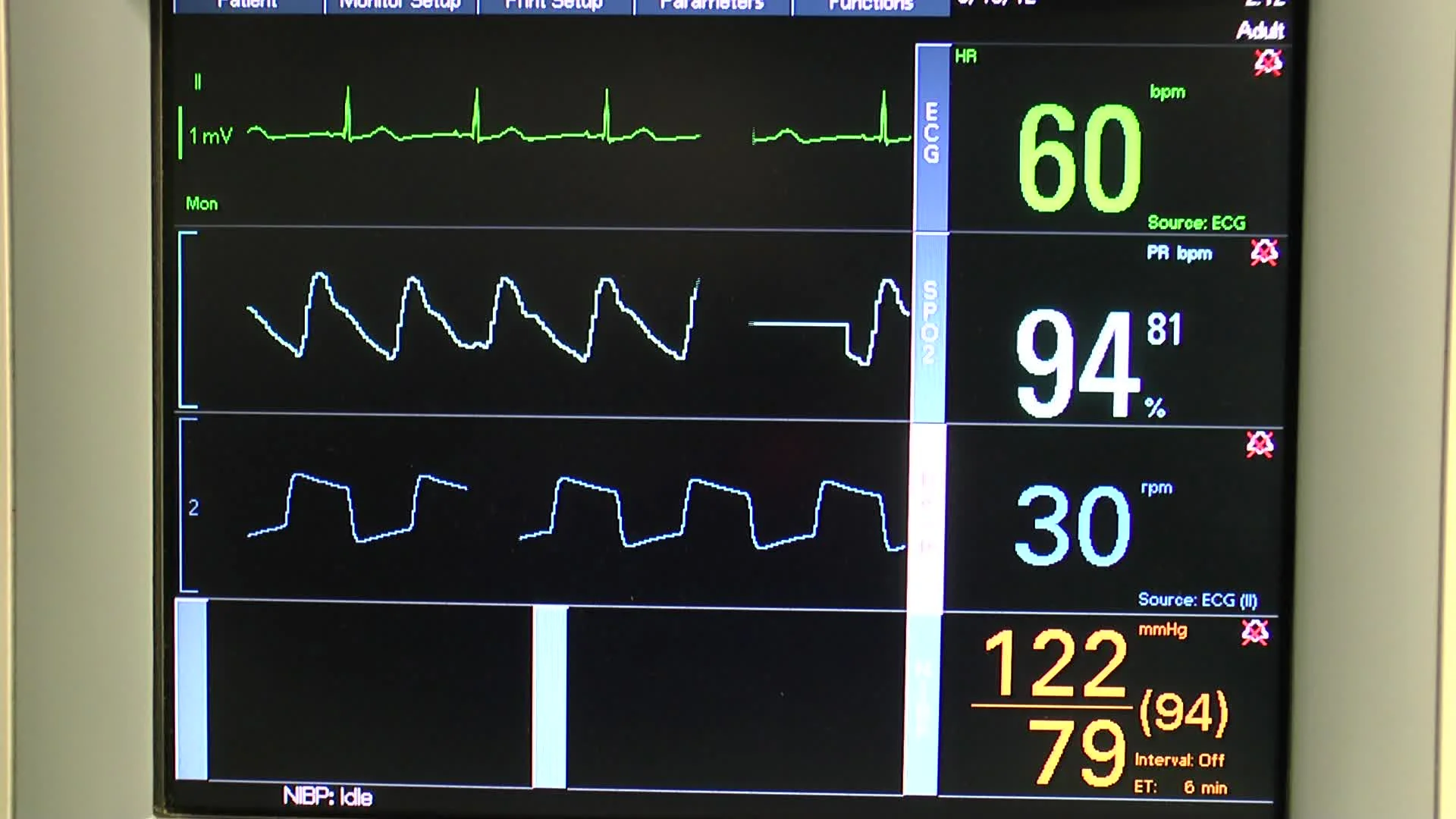 How to Read a Hospital Monitor: Understanding Vital Signs