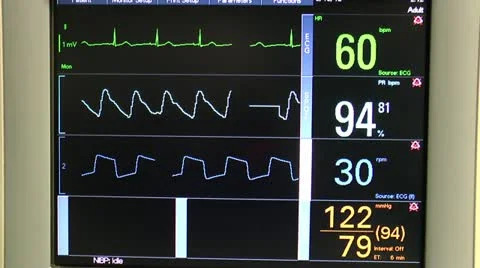 https://images.pond5.com/hospital-monitors-four-vital-signs-footage-012152683_iconl.jpeg