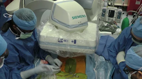 Hospital OR surgeons insert laparoscopic sheath closeup Video stock 147096405