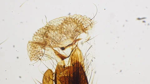 House Fly Mouth Under Microscope. Microscopic view of insect part. Scientif.. Stockbeeldmateriaal 332816902