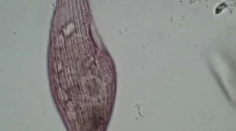 How the Blepharisma eats Video stock 38423241