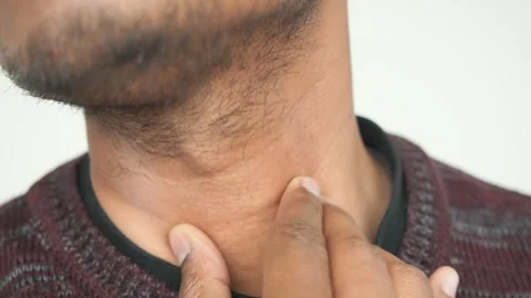How to check for a sore throat effectively at home Stock Footage 311222624