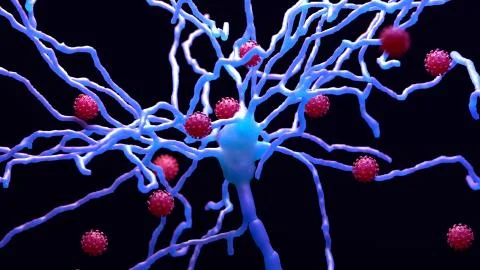 How COVID-19 can damage the brain, the deterioration of myelin a fatty coating Stock Illustration