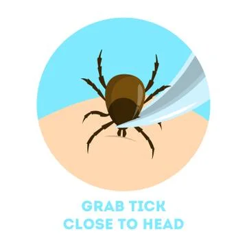 How to remove a mite insect. Brown parasite, risk of encephalitis Stock Illustration