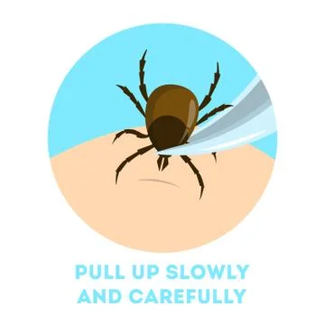 How to remove a mite insect. Brown parasite, risk of encephalitis Stock Illustration
