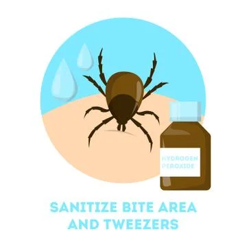 How to remove a mite insect. Brown parasite, risk of encephalitis Stockillustratie