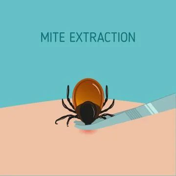 How to remove mite insect parasitic. Encephalitis Tick Warning Illustration