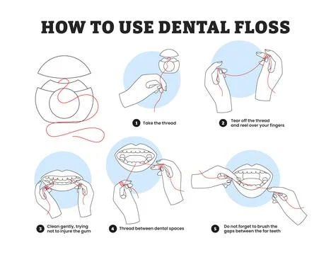 How to use dental floss step by step instruction educational infographic po.. イラスト素材