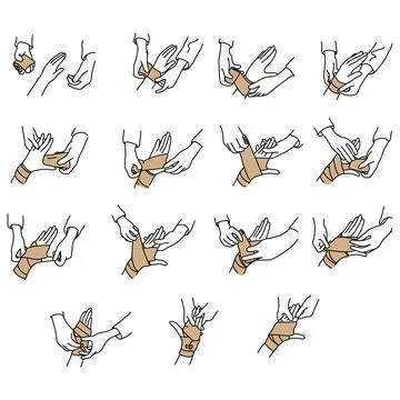 How to wrap a hand with elastic gauze vector illustration sketch hand drawn w Stock Illustration