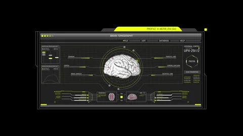 HUD Brain Tomography Scan Sci-Fi UI Medical Interface 動画素材 338389882