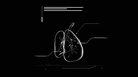 HUD lungs 150 Stock Footage 223385905