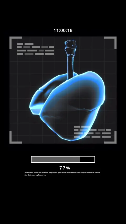 HUD X-ray image displayed Lung and Medical Data Display on computer monitor Stock Footage 271222195