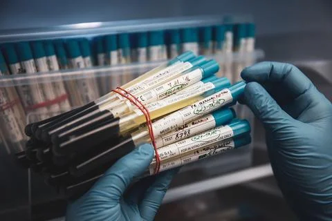 Huge collection of bacteria samples held in hands Stock Photos