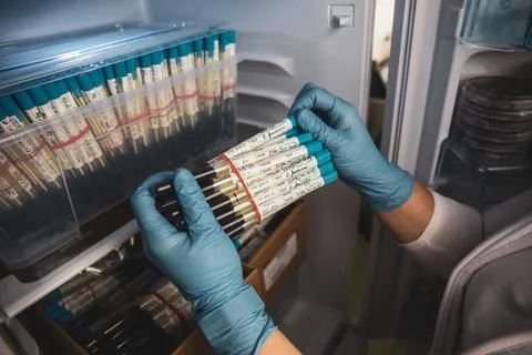 Huge collection of bacteria samples held in hands Foto stock