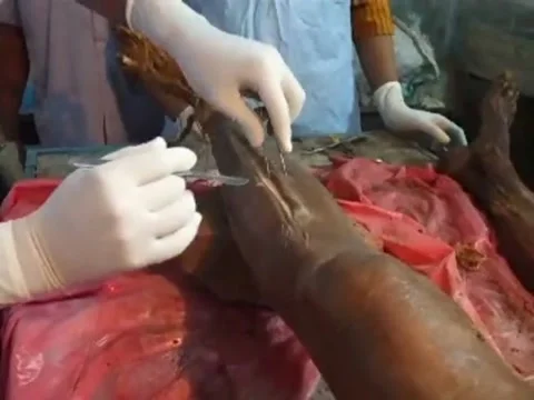 Human Anatomy Dissection of the Legs Stock Footage 185290580