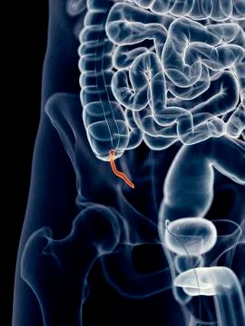 Human appendix Stock Illustration