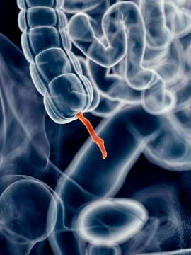 Human appendix Stock Illustration