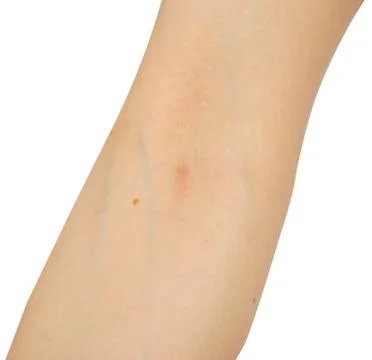 Human arm Stock Photos