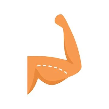 Human arm showing biceps flexing after plastic surgery Stock Illustration