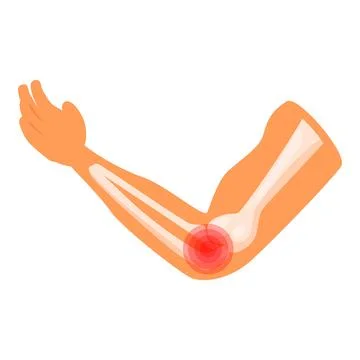 Human arm showing bones and painful elbow joint Illustrazione stock