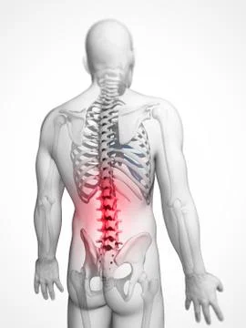 Human back pain, artwork Stock Illustration