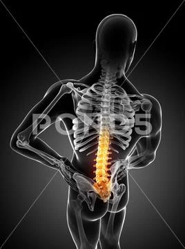 Human back pain, artwork Stock Illustration