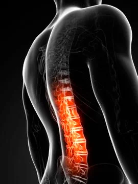 Human back pain, artwork Stock Illustration