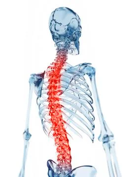 Human back pain, artwork Stock Illustration