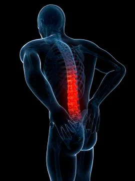 Human back pain, artwork Stock Illustration