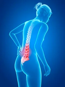 Human back pain, illustration Stock Illustration