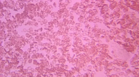 Human Blood 001 Stock Footage 49695340
