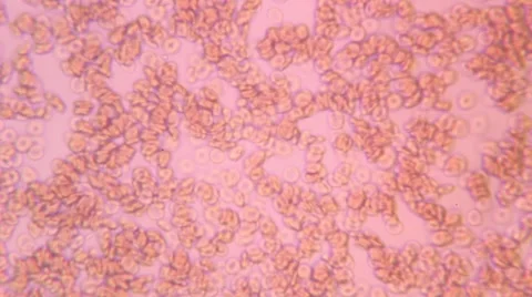Human Blood 002 Stock Footage 49695349