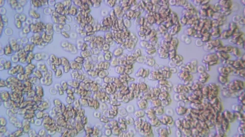 Human Blood 003 Stock Footage 49695503