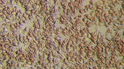 Human Blood 004 Stock Footage 49695577