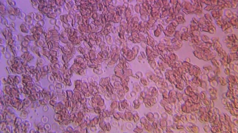 Human Blood 005 Stock Footage 49695598