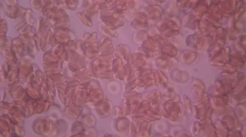 Human Blood 006 Stock Footage 49695687