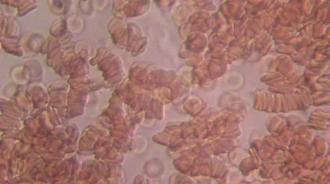 Human Blood 007 Stock Footage 49695745