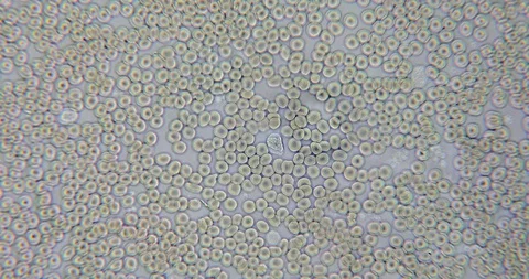 Human blood in microscope Stock Footage 129408726