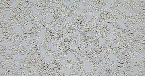 Human blood in microscope Stock Footage 129408762