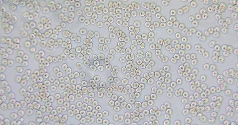 Human blood in microscope Stock Footage 129408776