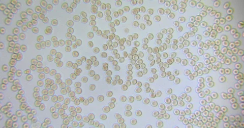 Human blood in microscope 動画素材 129408782