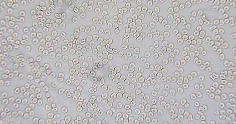 Human blood in microscope 動画素材 129408855