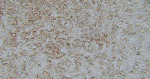 Human blood in microscope 動画素材 129408977