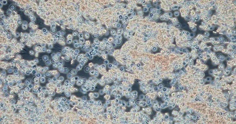 Human blood in microscope 動画素材 129409014