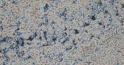 Human blood in microscope 動画素材 129409037