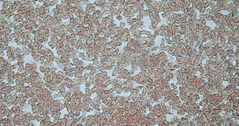 Human blood in microscope 動画素材 129409087