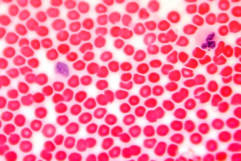 Human blood smear under microscope Stock Photos