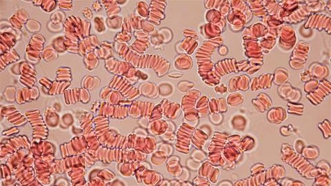 Human blood under a microscope. You can see erythrocytes - red blood cells... Stock Photos